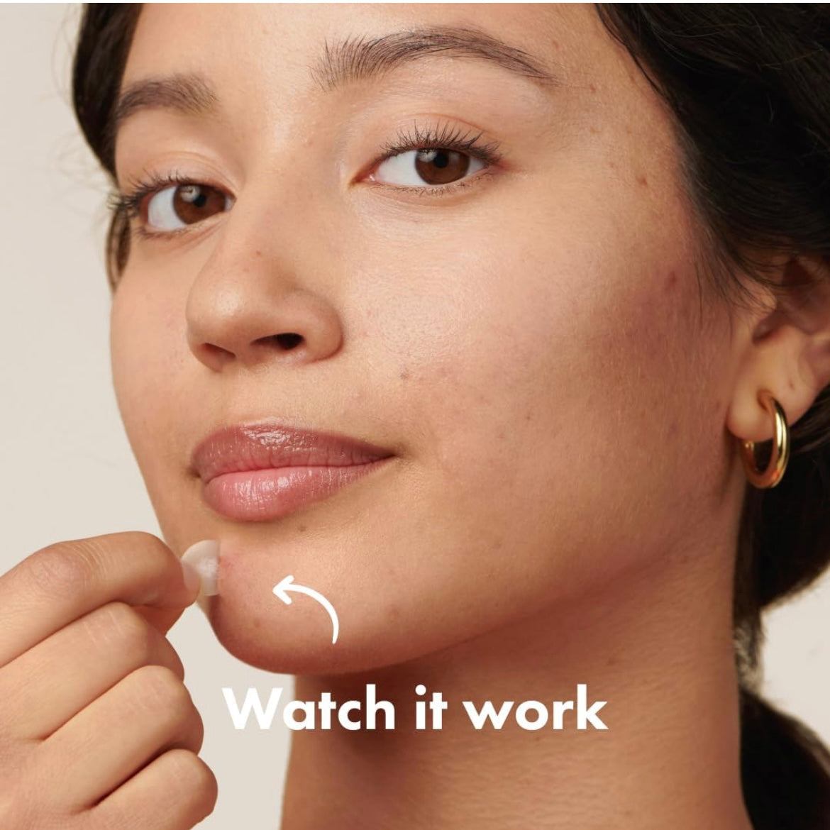 Mighty Patch™ Original patch from Hero Cosmetics – The #1 Hydrocolloid Acne Pimple Patch for Shrinking Zits and Whiteheads in 1 use; Nighttime Spot Stickers for Face and Skin (72 Count